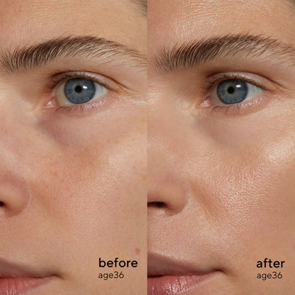 Retinol Alternative Plant-Powered Serum, 30ml